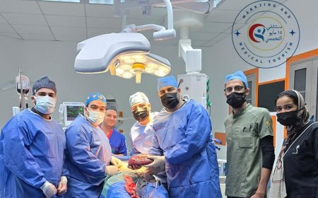 " مستشفى 15مايوالتخصصي " تنجح فى جراحة استئصال الطحال سيدة 50 عام