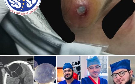 "مستشفى ١٥ مايو النموذجي  " نجاحات مستمرة لإنقاذ المرضة