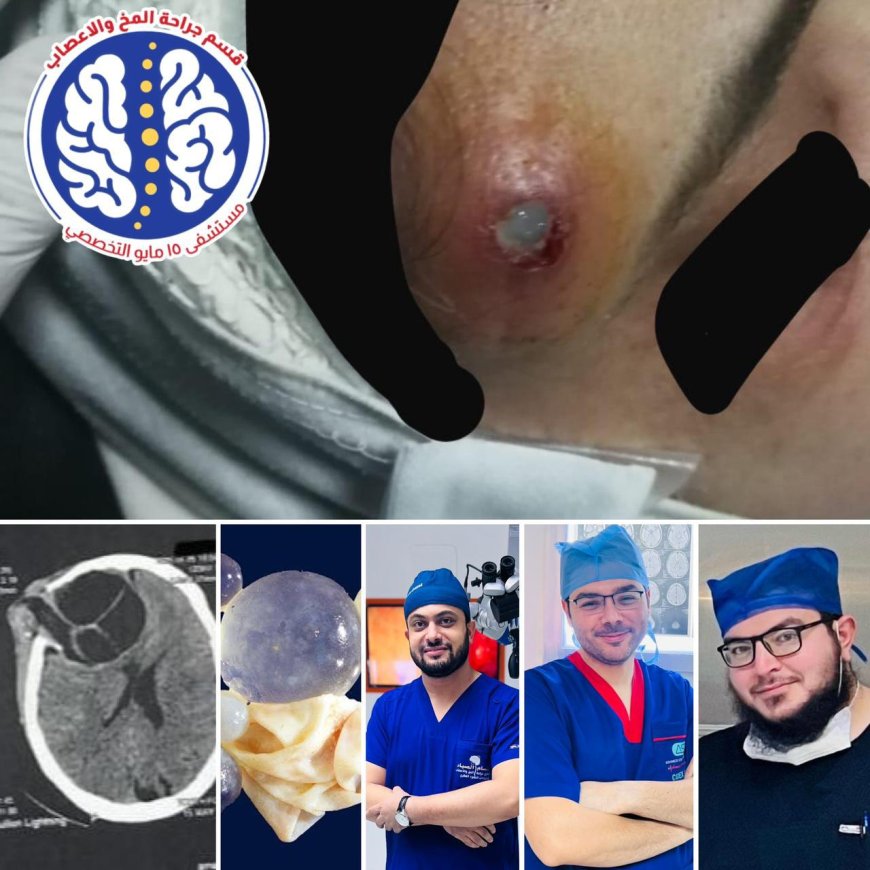 "مستشفى ١٥ مايو النموذجي " نجاحات مستمرة لإنقاذ المرضة