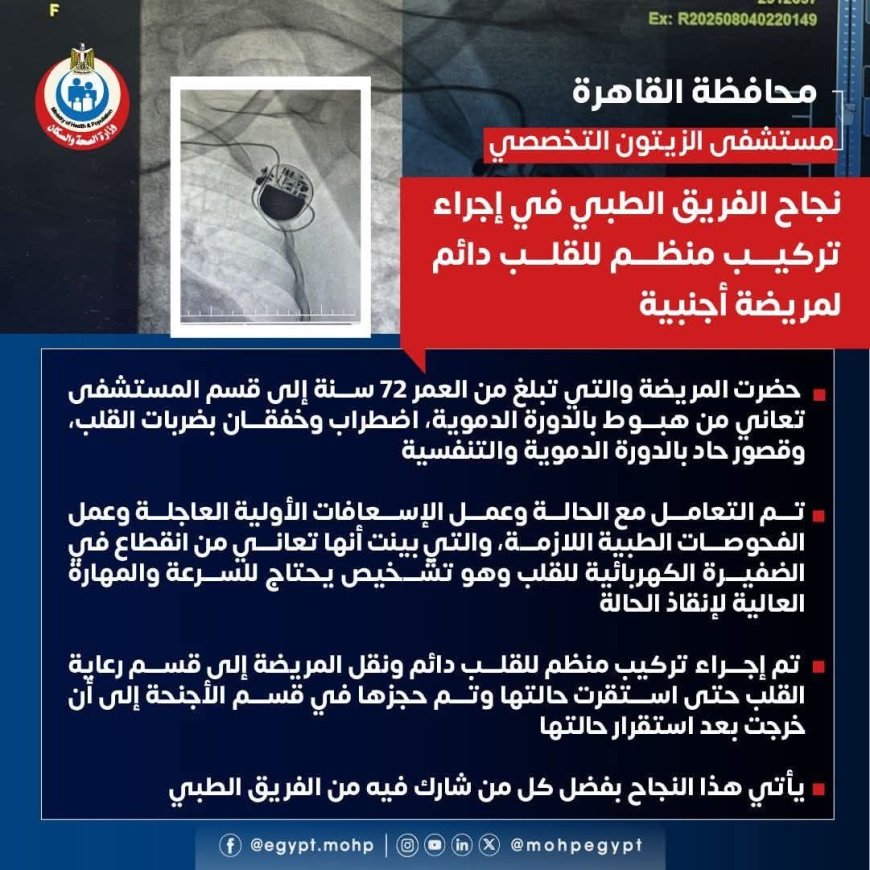 " مستشفى الزيتون التخصصى" نجاح جديد بوحدة القلب  في إجراء تركيب منظم للقلب دائم لمريضة أجنبية تبلغ من العمر  ٧٢ سنة