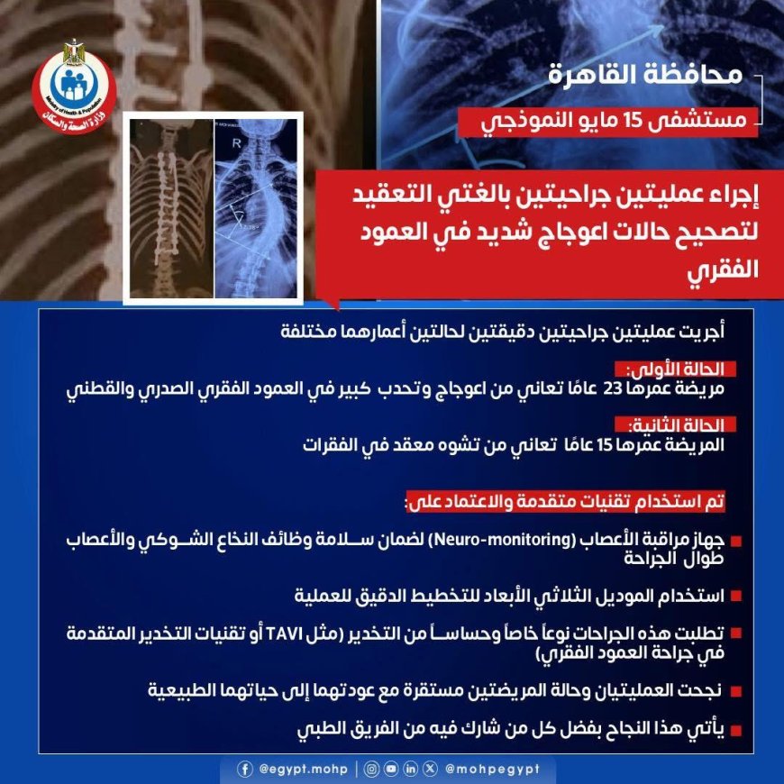 " مستشفى ١٥ مايو " نجاح جديد بمجهودات  إنجاز طبي جديد في جراحة العمود الفقري