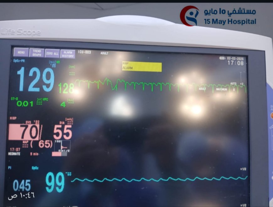 إنجاز طبي جديد بمستشفى 15 مايو التخصصي: إنقاذ مولود حديث يعاني من انسداد كامل بفتحة الشرج