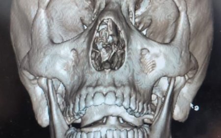 عيادات الأسنان تقدم خدماتها لـ428 مريضًا خلال عيد الفطر المبارك.. ونجاح جراحة وجه وفكين عاجلة بمستشفى عين شمس العام