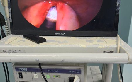 نجاح مستشفى منشية البكري العام في إجراء جراحة دقيقة لاستئصال لحمية بالأحبال الصوتية