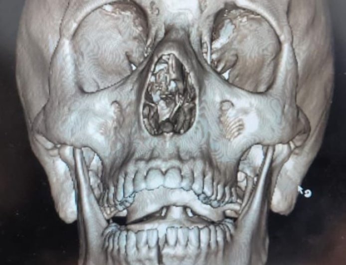 عيادات الأسنان تقدم خدماتها لـ428 مريضًا خلال عيد الفطر المبارك.. ونجاح جراحة وجه وفكين عاجلة بمستشفى عين شمس العام