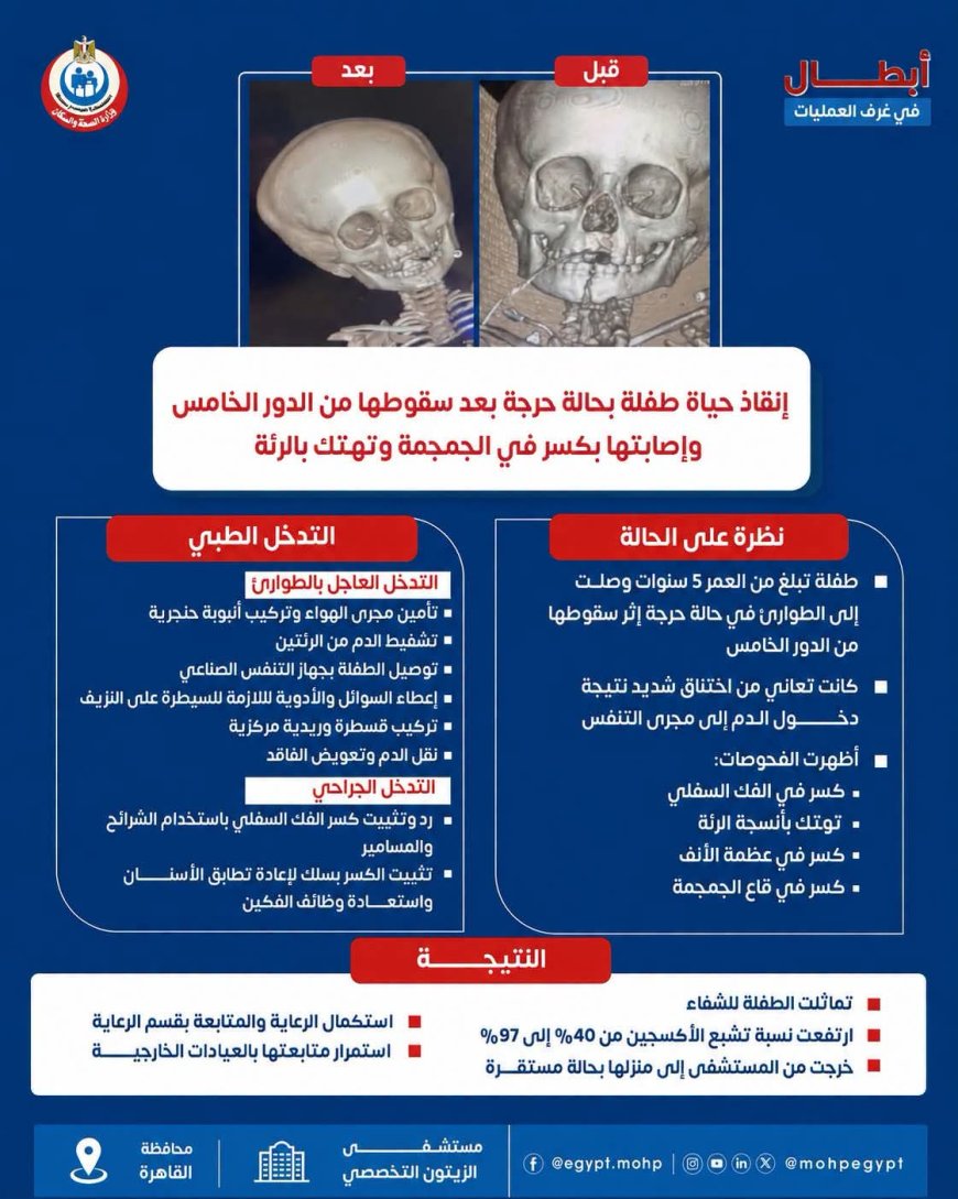 ملحمة طبية داخل مستشفى الزيتون التخصصي.. تدخلات عاجلة ورعاية دقيقة تنقذ طفلة من إصابات بالغة وتهتك بالرئة